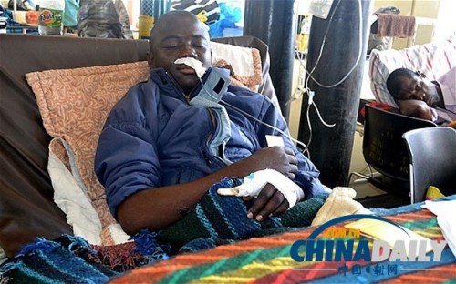 雖然已經在醫院接受了近一個月的恢復治療，卡托卡的身體仍然非常虛弱。