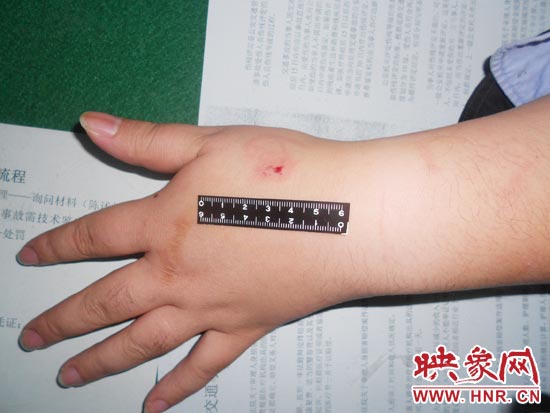 為幫助無證駕駛的朋友逃避處罰，新鄉的王某竟對執勤民警大打出手，還將一名民警的手臂咬傷