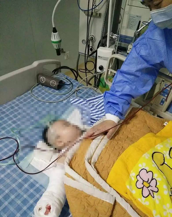 “嬰兒不小心被熱水燙傷，到寧波婦女兒童醫院住院，醫生換紗布時竟然剪下嬰兒小拇指！”近日，網友“menglei1988”以當事嬰兒家長口吻在寧波當地論壇發帖。
