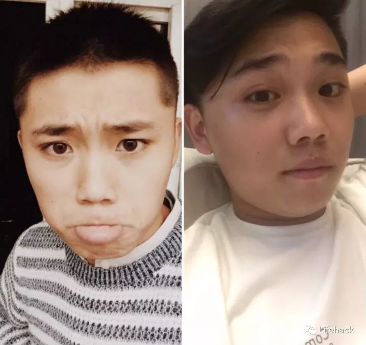 長胖20斤，臉型怎么變？這些例子看完扎心了！