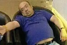 網傳金正男中毒后的照片。