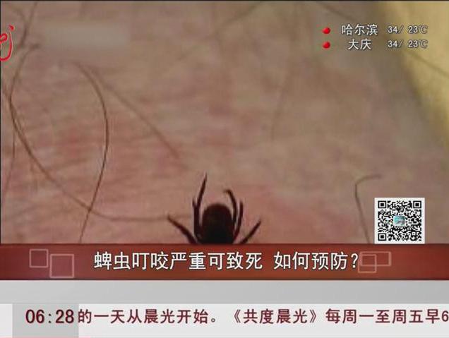 蜱蟲叮咬嚴(yán)重可致死如何預(yù)防？